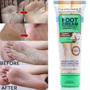 کرم ترک پا ووکالی